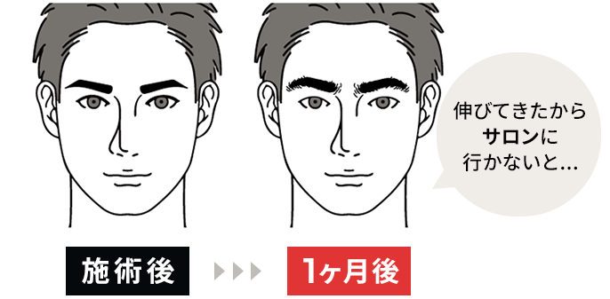 1か月後 伸びてきたからサロンに行かないと...