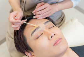 ビフォーアフター 施術例3