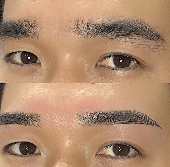 平行ストレート