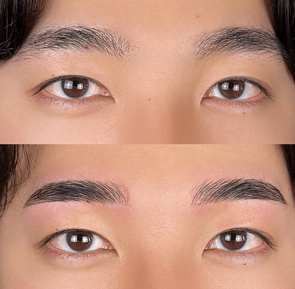 平行ストレート