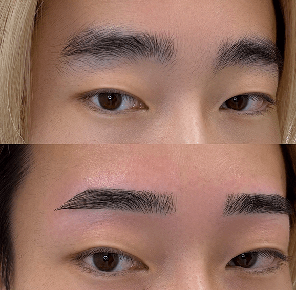 平行ストレート