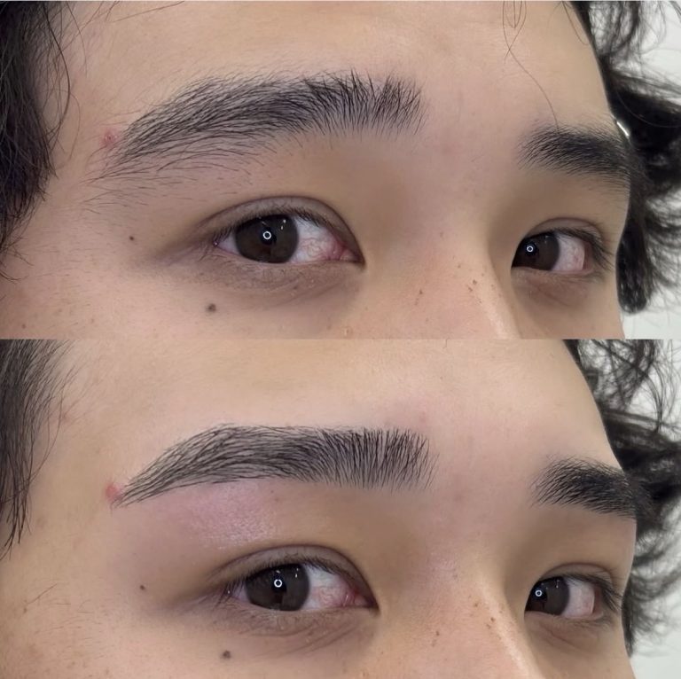平行ストレート