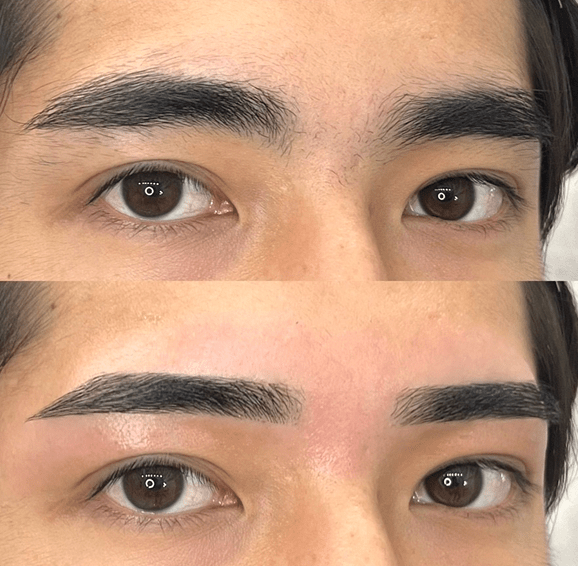 平行ストレート